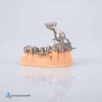Magnum Dentallegierung