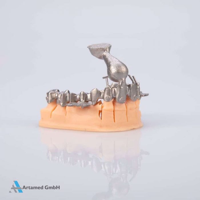 Magnum Dentallegierung